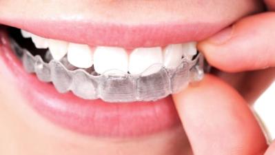 Dr. Evan Wiens and Invisalign