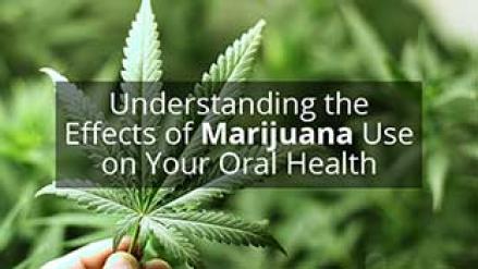 Cannabis and your teeth